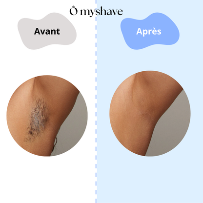 Epilateur à lumière pulsée IPL - Ô myshave