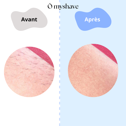 Epilateur à lumière pulsée IPL - Ô myshave